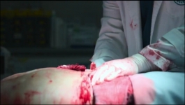 The Trauma Code Heroes On Call (Hindi) - Season 01 Episode 05